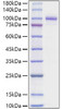 Recombinant Mouse Periostin/PN/POSTN Protein (RPCB1169)