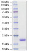Recombinant Rat IL-2 Protein (RPCB1179)
