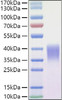 Recombinant Mouse Ephrin-B2/EFNB2 Protein (RPCB1184)