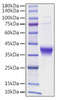 Recombinant human Ephrin-A3/EFNA3 Protein (RPCB1185)