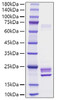 Recombinant Rat IL-1 alpha Protein (RPCB1186)