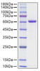 Recombinant Human HMGB1-EGFP Protein (RPCB1187)