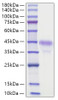 Recombinant Mouse R-spondin-1/RSPO1 Protein (RPCB1191)