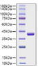 Recombinant Human CCL4/MIP-1Î² Protein (RPCB1199)