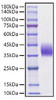 Recombinant Mouse B7-DC/PD-L2/CD273 Protein (RPCB1202)