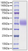 Recombinant Mouse TFPI Protein (RPCB1203)
