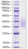 Recombinant Human CD320 Protein (RPCB1210)