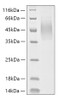 Recombinant Human MUC-16/CA125 Protein (RPCB1214)