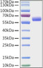 Recombinant Mouse LAG-3/CD223 Protein (RPCB1215)