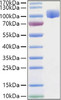 Recombinant Human ROBO4 Protein (RPCB1217)