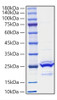 Recombinant Mouse FGF-9 Protein (RPCB1222)
