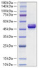 Recombinant Human ApolipoproteinA-IV/APOA4 Protein (RPCB1223)