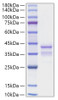 Recombinant Mouse TGF-alpha Protein (RPCB1226)
