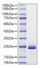 Recombinant Mouse FGF-21 Protein (RPCB1229)