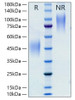Recombinant Rat CSF-1/M-CSF Protein (RPCB1231)