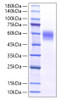 Recombinant Mouse IL-6RA/CD126 Protein (RPCB1239)