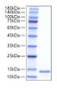 Recombinant Mouse CCL11/Eotaxin Protein (RPCB1245)