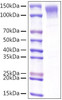 Recombinant Mouse Low-density lipoprotein receptor/LDLR Protein (RPCB1249)