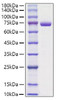 Recombinant Mouse Periostin/PN/POSTN Protein (RPCB1251)