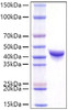 Recombinant Mouse YKL-40/CHI3L1 Protein (RPCB1262)