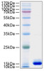 Recombinant Human PMP2 Protein (RPCB1266)