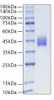 Recombinant Human TEM8/ANTXR1 Protein (RPCB1267)