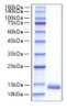 Recombinant Mouse CCL22/MDC Protein (RPCB1268)