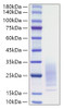 Recombinant Mouse IL-31 Protein (RPCB1276)