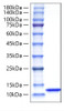 Recombinant Rat  CXCL1/GRO-alpha  Protein (RPCB1282)