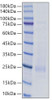 Recombinant Rat IL-18 Protein (RPCB1283)