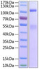 Recombinant Human IGF1R/CD221 Protein (RPCB1290)