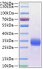 Recombinant Human Angiopoietin-like 4/ANGPTL4(166-406) Protein (RPCB1291)