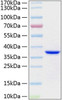Recombinant Human Annexin A5/ANXA5 Protein (RPCB1301)