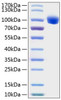 Recombinant Human ROR1 Protein (RPCB1303)