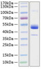 Recombinant Human BMPR-1B/ALK-6/CDw293 Protein (RPCB1317)