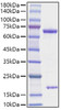 Recombinant Rat PCSK9 Protein (RPCB1325)