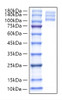 Recombinant Human Integrin alpha V beta3 (ITGB3ï¼†ITGAV) Protein (RPCB1332)