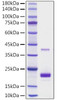 Recombinant Mouse TNFSF5/CD40 ligand/CD154 Protein (RPCB1341)