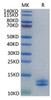 Recombinant Human Calgranulin-A&Calgranulin-B/S100A8&S100A9 Protein (RPCB1345)
