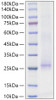 Recombinant Mouse IL-17E Protein (RPCB1353)