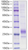 Recombinant Mouse IL-33 Protein (RPCB1356)