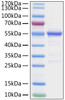 Recombinant SARS-CoV-2 Nucleocapsid(G335A) Protein (RPCB1358)