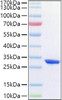 Recombinant Human Complement factor D/CFD Protein (RPCB1380)