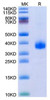 Recombinant SARS-CoV-2 Spike RBD(B.1.640.2/IHU) Protein (RPCB1383)