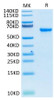 Recombinant SARS-COV-2 Spike RBD  Protein (RPCB1386)