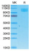 Recombinant Cynomolgus ACE-2 Protein (RPCB1393)
