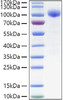 Recombinant Human IL-23R Protein (RPCB1395)