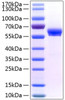 Recombinant Human FAM3B/PANDER Protein (RPCB1402)