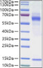 Recombinant Human Vitronectin/V75/VTN Protein (RPCB1404)