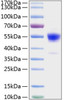 Recombinant Rat IFN-gamma Protein (RPCB1408)